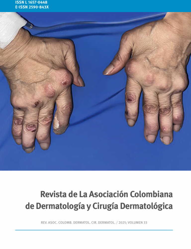 Revista de la Asociación Colombiana de Dermatología y Cirugía Dermatológica